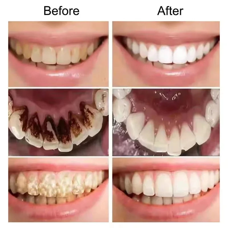 Pasta de dentes  para clareamento dos dentes.